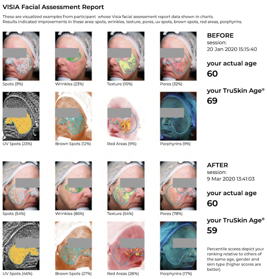 Sensitive Skin in the Urban World: More Than Just a Feeling