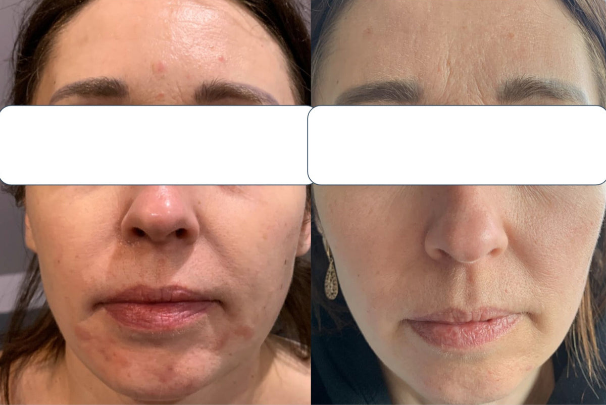 before and after skin condition